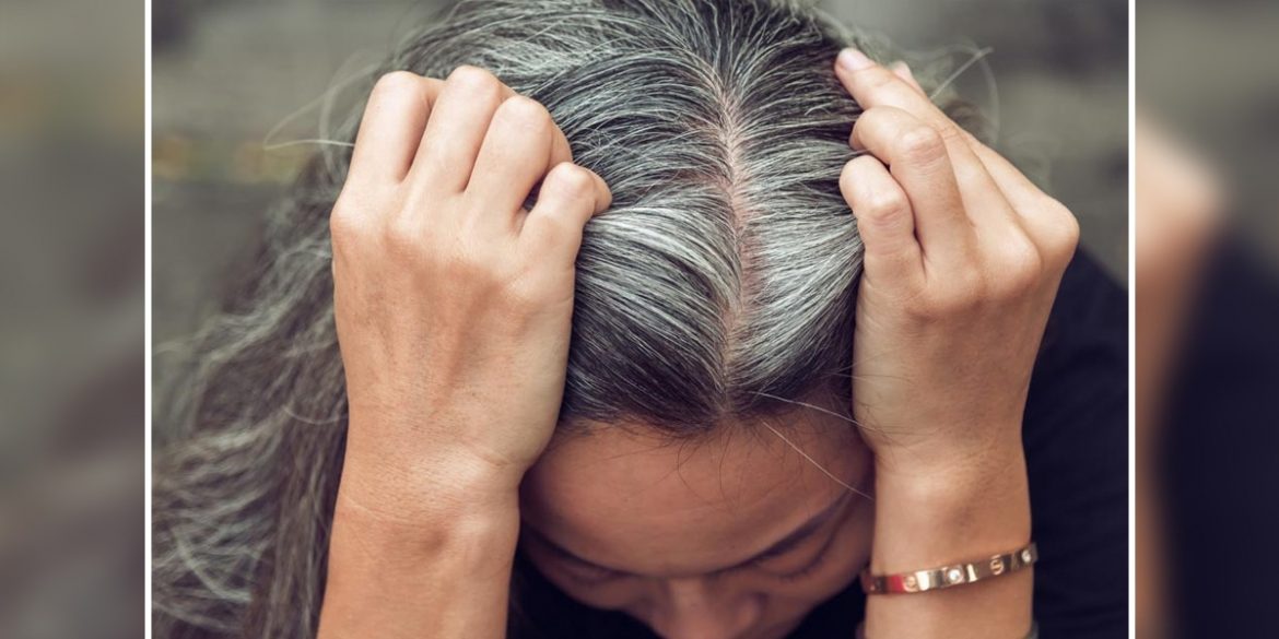 Natural remedies to prevent premature greying of hair