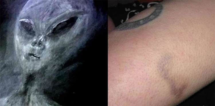 Woman claims abduction by aliens, shares ‘evidence’