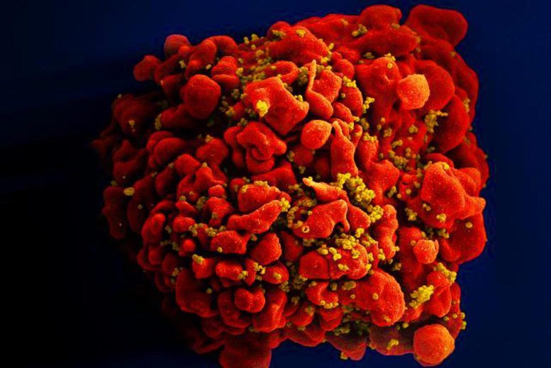 HIV Accelerates Aging by 5 Years